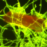 Marine scientists discover plastic-eating fungus in Pacific Garbage Patch